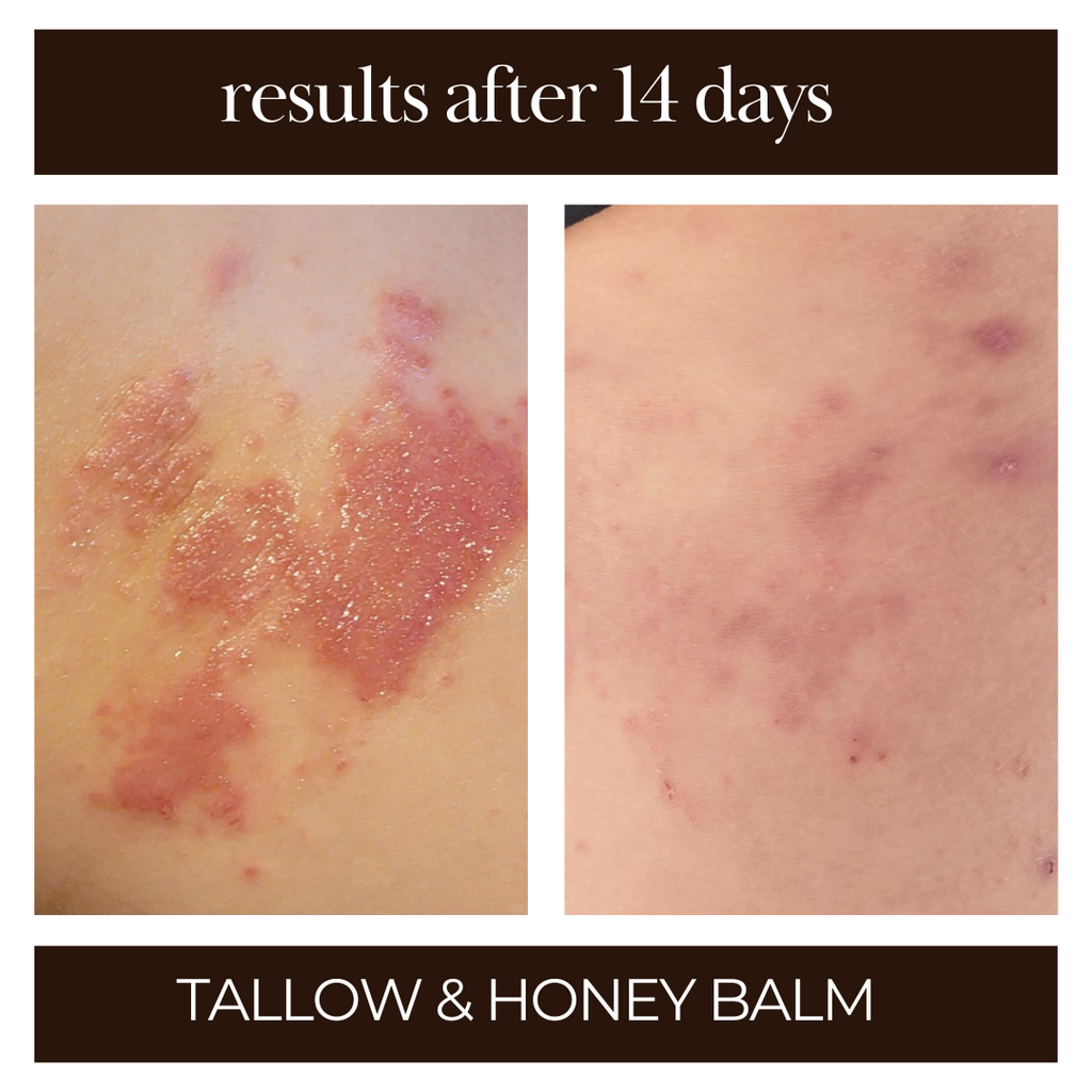 Tallow & Honey Balm