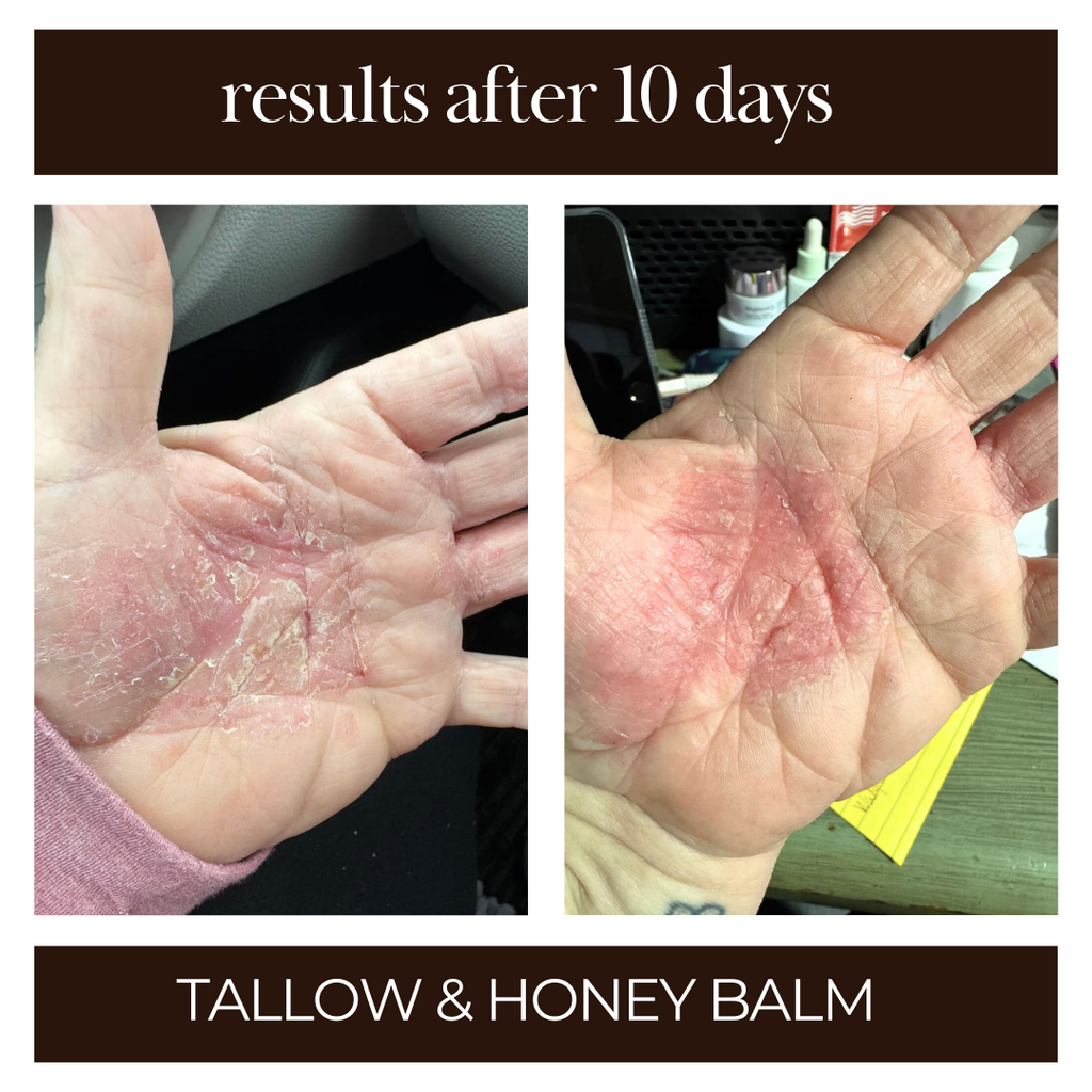 Tallow & Honey Balm